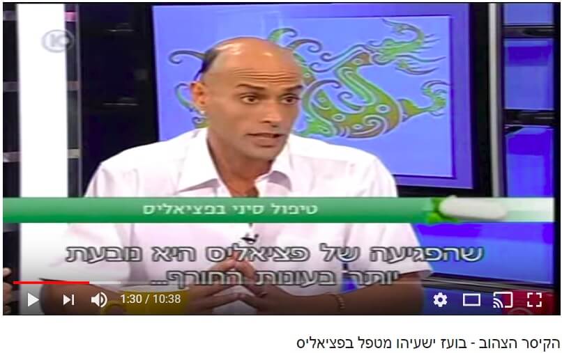 פציאליס